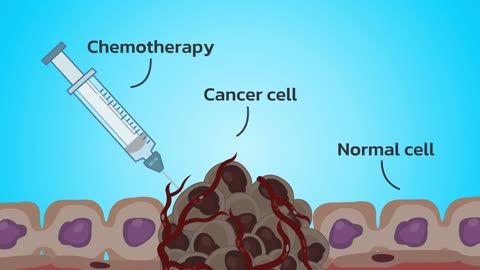 Prostate Cancer Journey: Prevention, Treatment, Healing & Recovery, Diagnosis Through Recovery