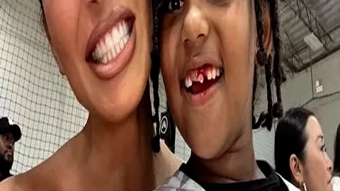 Celebrity Dentist Warns of Tooth Art Danger After