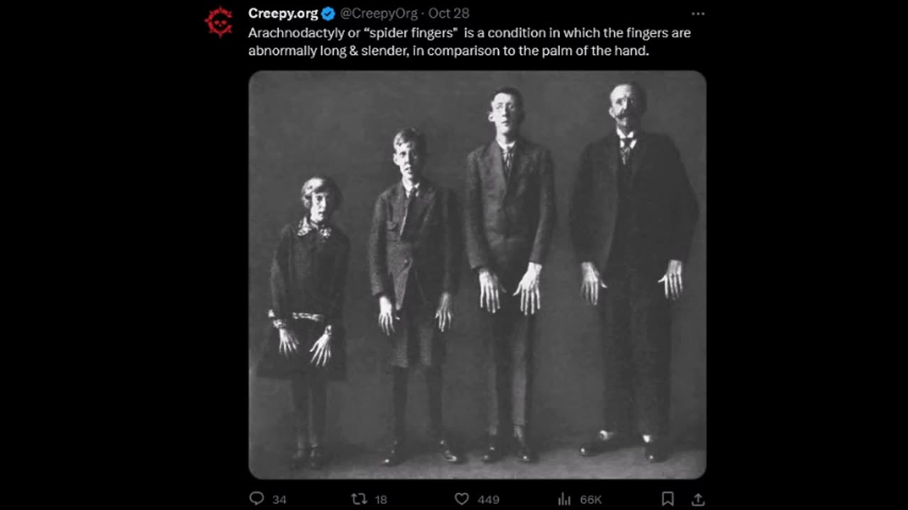 Creepy - Spider Fingers