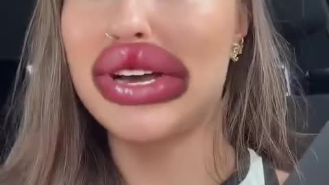 uraine on the Brain 2025