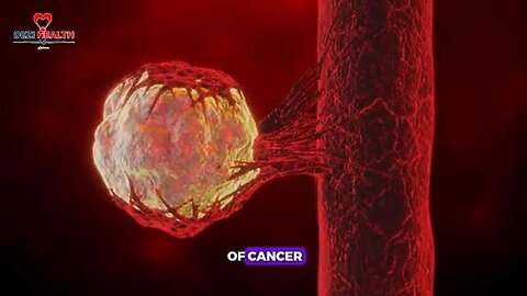 6 Fruits Are Cancer’s Worst Enemy - Barbara O'Neill