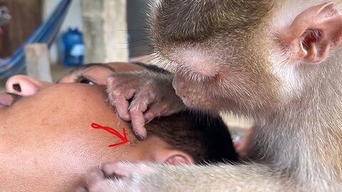 OMG!! Monkey Zueii Remove Acne And Give New Skin Care For Her Brother