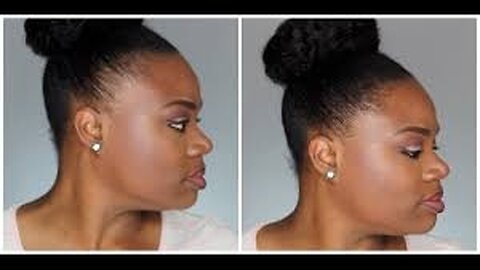 Finding Edges- Supplements That Helped Me regrow My Hairline