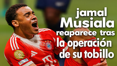 🏥 JAMAL MUSIALA HABLA TRAS CIRUGÍA DE TOBILLO: “NADIE TIENE LA CULPA” 🦵