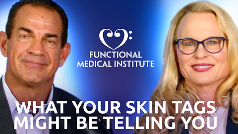 What Your Skin Tags Might Be Telling You