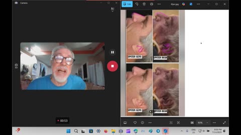 IMPOSTURE BODY OF EPSTEIN, The Jeffery Epstein Autopsy Photos,