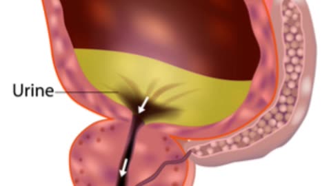 MANUP PROSTATE HEALTH