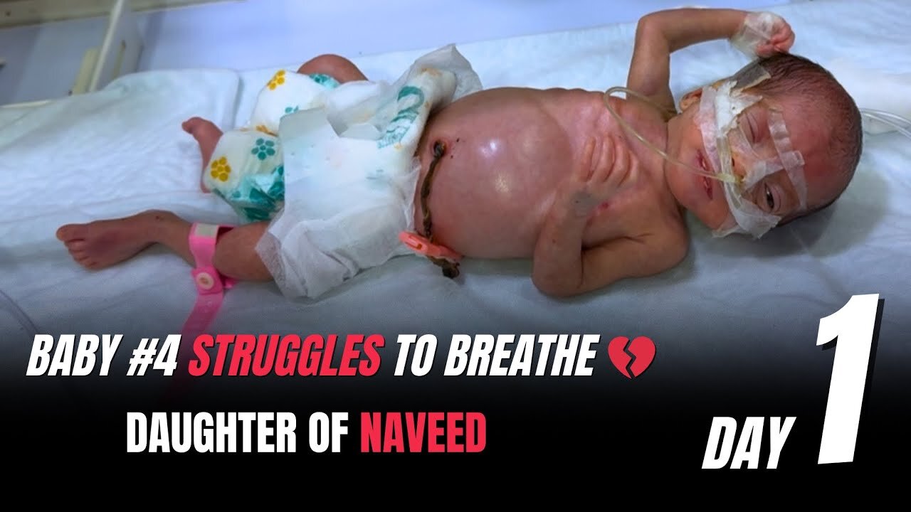 Inside a Preemie's First 24 Hours of Life | Daughter Of Naveed Day 1 | #premature #baby