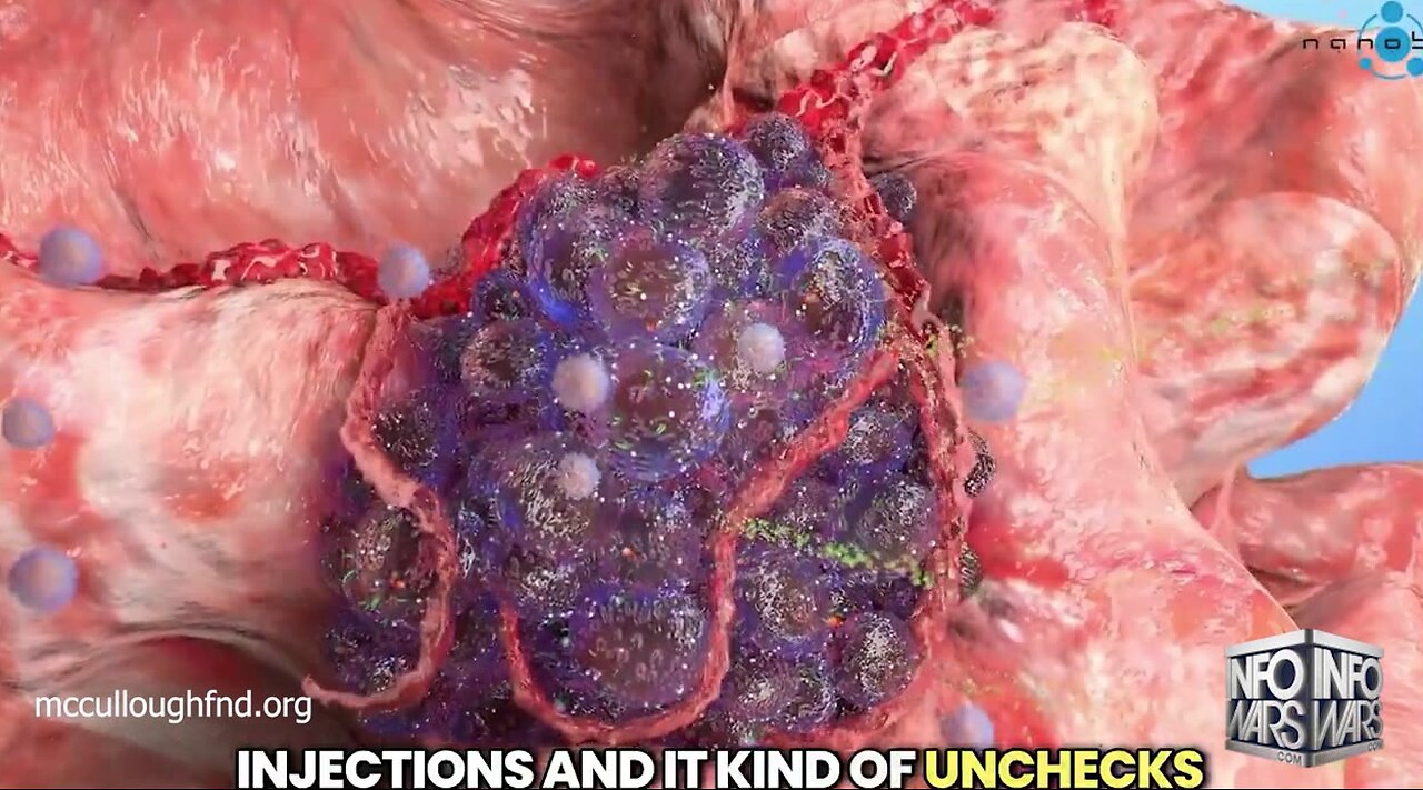 Top Oncologists Warn: 'Turbo Cancer Set to Explode' Among Covid-Vaccinated
