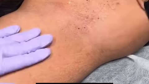 Underarm Waxing Using Sexy Smooth Golden Allure Hard Wax by @lashedwithlana