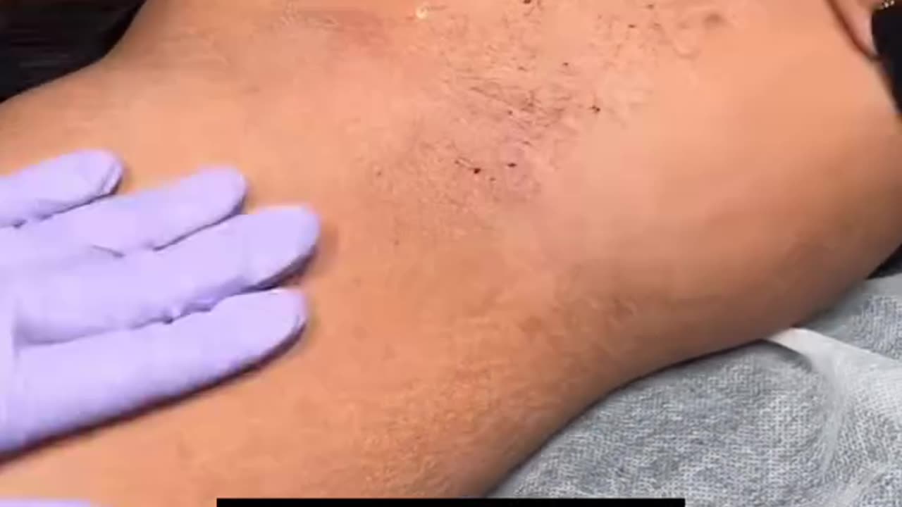 Underarm Waxing Using Sexy Smooth Golden Allure Hard Wax by @lashedwithlana