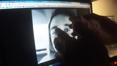 Luodong Gives Online Treatment To Man With Hood