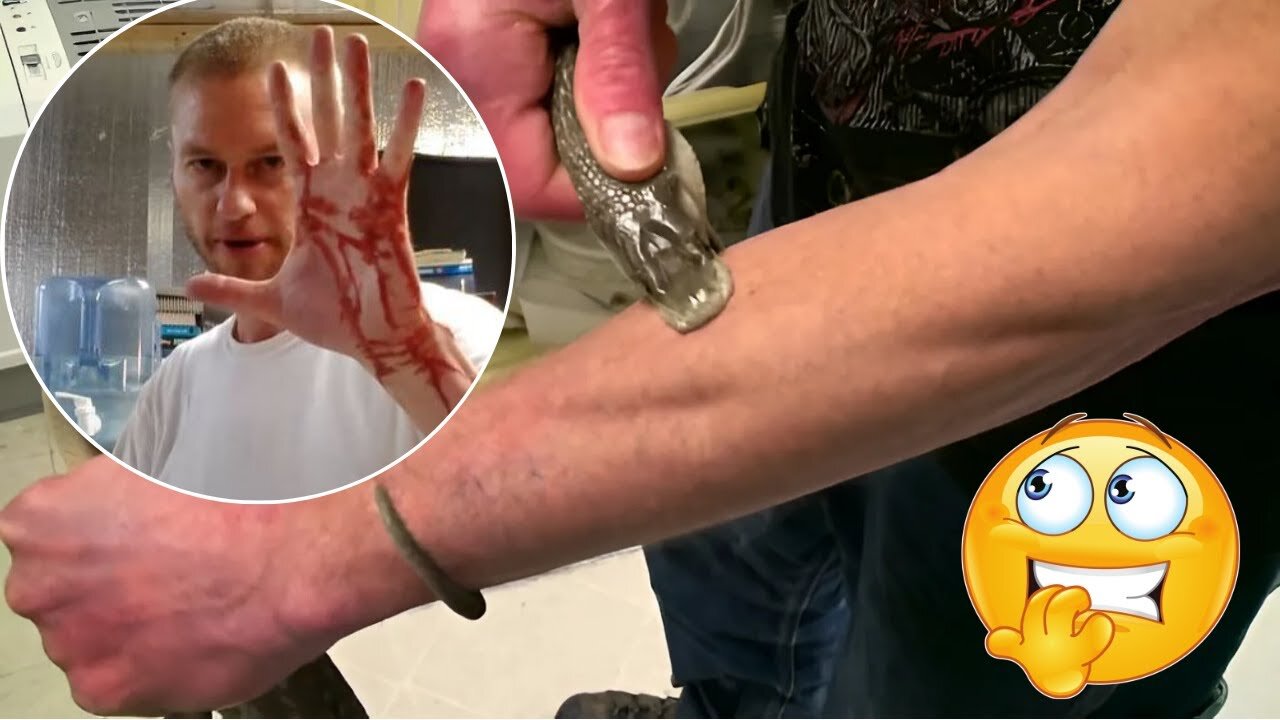 He lets snakes bite him for 18 years, now hes a human antidote 🐍