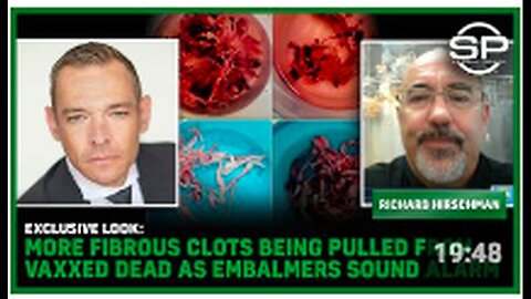 EXCLUSIVE LOOK - MORE Fibrous Clots Being Pulled From Vaxxed DEAD As Embalmers Sound Alarm