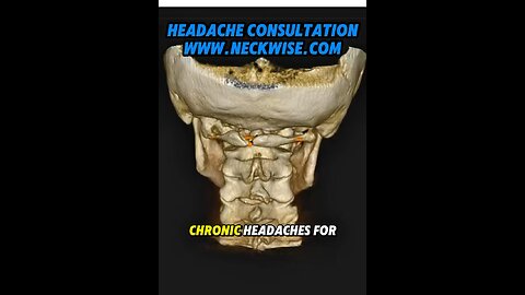 Why whiplash injury can be at root cause of headaches | Neckwise upper cervical chiropractic