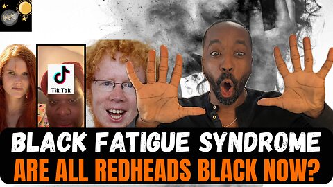 Black fatigue syndrome. Are all redheads black? New tiktok trend