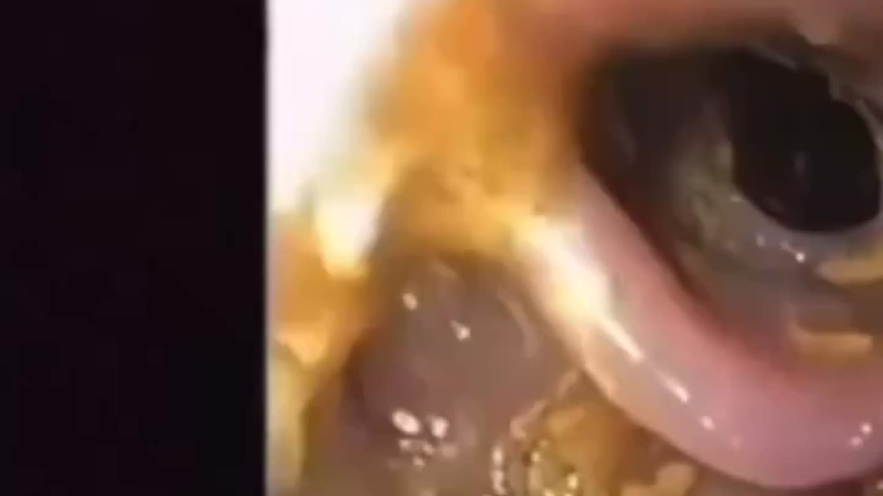 As you parasite cleanse and heavy metals detox you...