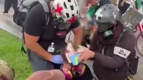 LA rioter got hit in the head with a less lethal munition. Scalp wounds bleed a lot