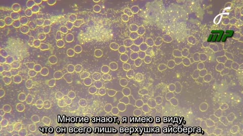 НАНОТЕХНОЛОГИИ обнаружены во ВСЕХ вакцинах.