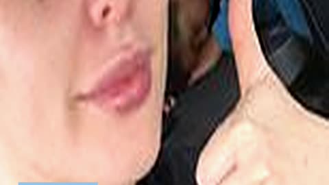 Helen Flanagan Sports Painful Looking Black E