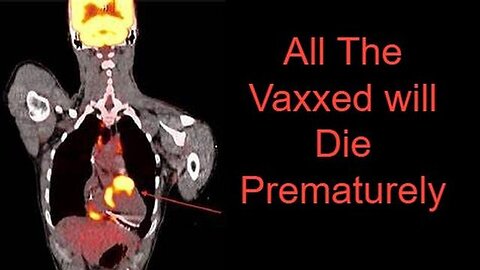 "Understanding The Impact of Vaccination on Lifespan: Bust the Myths"