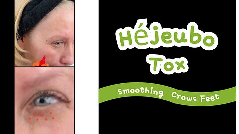 Hejeubo to Soften Crow's Feet