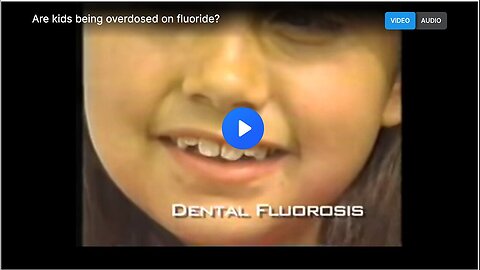 "Potential Overdose of Fluoride in Children"