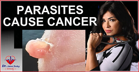 "Unveiling the Link Between Parasites and Cancer: Insights by Dr. Jane Ruby"