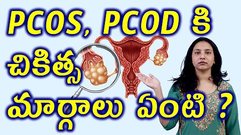 PCOS PCOD కి చికిత్స మార్గాలు ఏంటి? Best Treatment Option for PCOS PCOD Homeopathy Cure Medicine