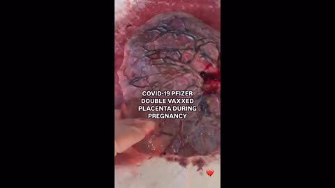 Revelation 16- Final Judgement! "Blood Of The Innocent!"