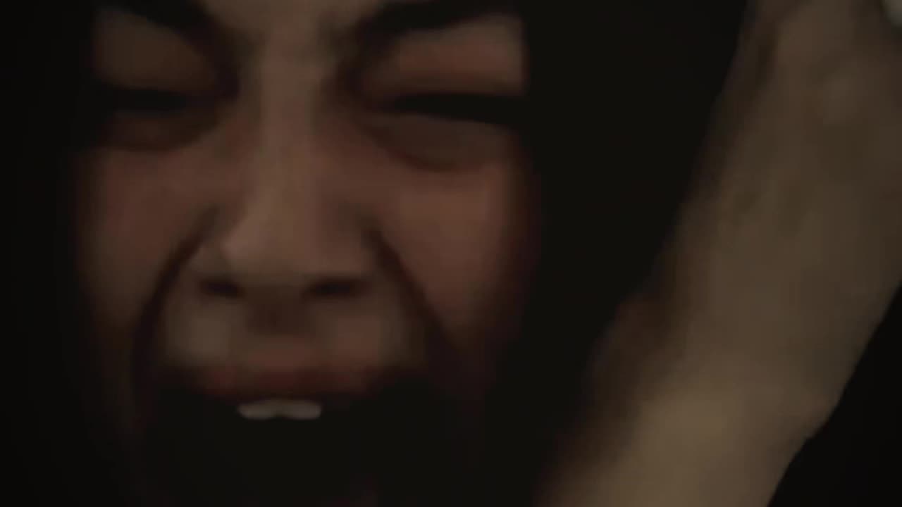 Only Love Can Hurt Like This