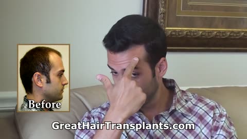 Dr. Brett Bolton Delivers Another Amazing Hair Transplant