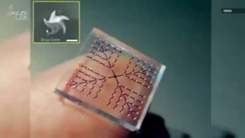 THE VACCINE OF THE FUTURE THE MICRONEEDLE VACCINE