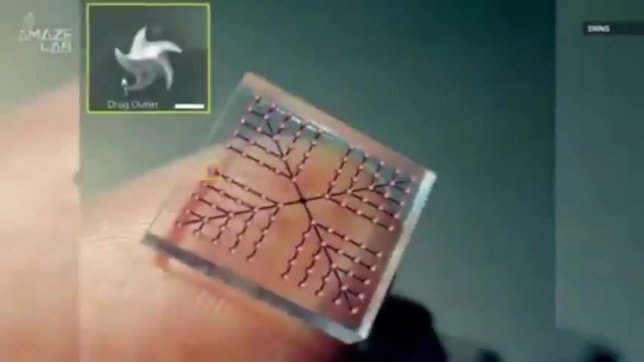 THE VACCINE OF THE FUTURE THE MICRONEEDLE VACCINE