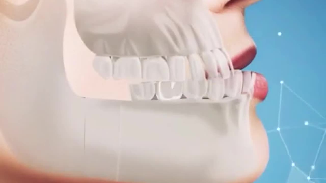 surgical correction of bite