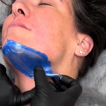 @Modalityesthetics Upper Lip & Chin Waxing Demo | Sexy Smooth Sexy Sapphire Hard Wax for Sensitive