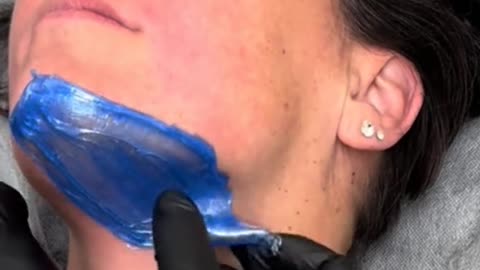 @Modalityesthetics Upper Lip & Chin Waxing Demo | Sexy Smooth Sexy Sapphire Hard Wax for Sensitive