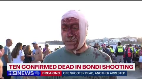 Injured Jewish man in Bondi who was in Israel during Oct 7, so fake wow