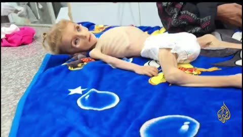 A child has died of malnutrition in Deir al-Balah.