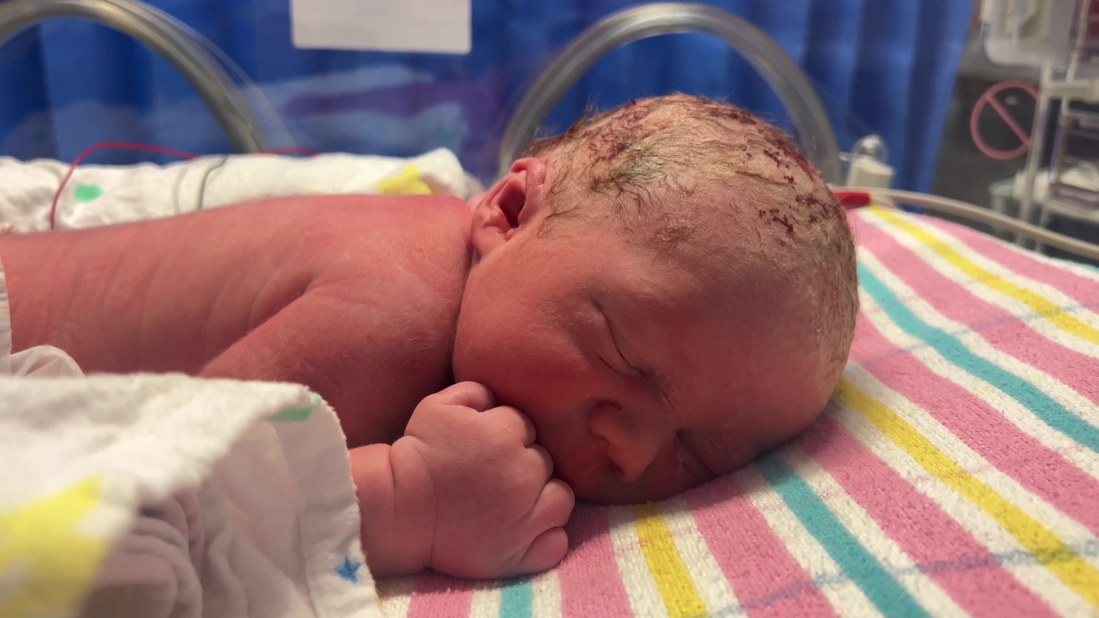 Newborn Baby Boy Shows Hunger Cues in Humidicrib Hours After Birth