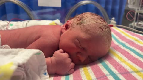 Newborn Baby Boy Shows Hunger Cues in Humidicrib Hours After Birth 