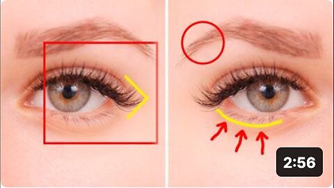 "Decoding Health Signals: 5 Messages Your Eyes Are Sending"