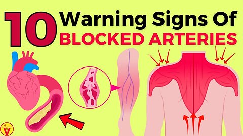 10 Alert Signs of Clogged Heart Arteries in Legs and Feet | VJ16