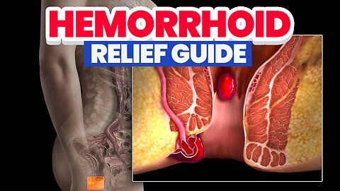 Hemorrhoids: Natural Relief, Symptoms & Prevention You Wish You Knew Sooner