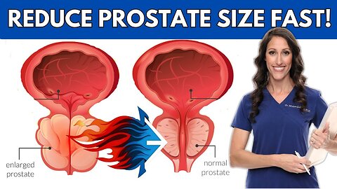 Try This Unique Herb to Slim Down Prostate Dimensions! N09