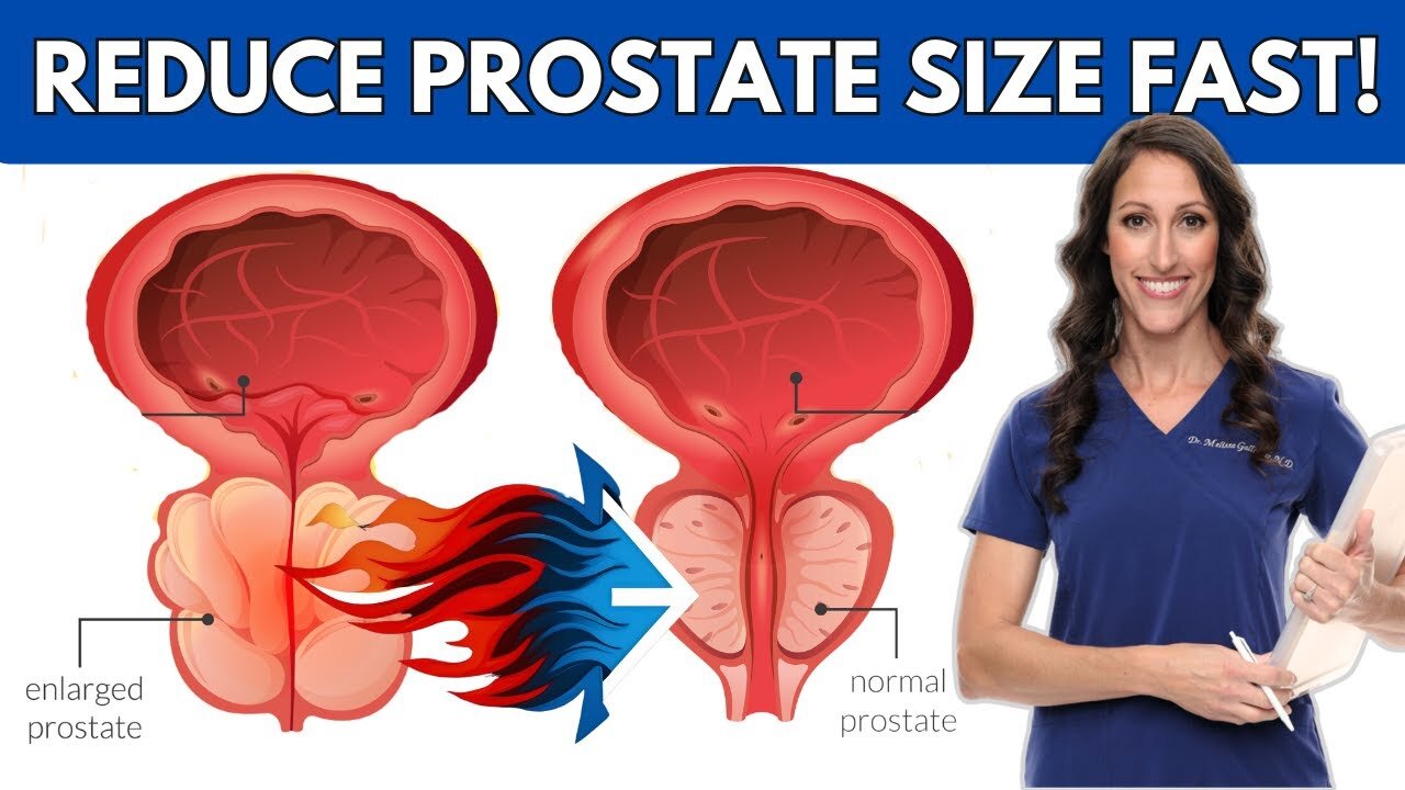 Try This Unique Herb to Slim Down Prostate Dimensions! N09
