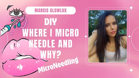 After microneedling LETS talk where I like to microneedle and WHY
