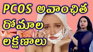 PCOS అవాంఛిత రోమాల లక్షణాలు Signs of Hirsutims in PCOS Female Unwanted Hair Homeopathy Medicine Cure