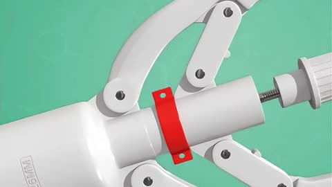 Circumcission Surgery Process (3D Animation)