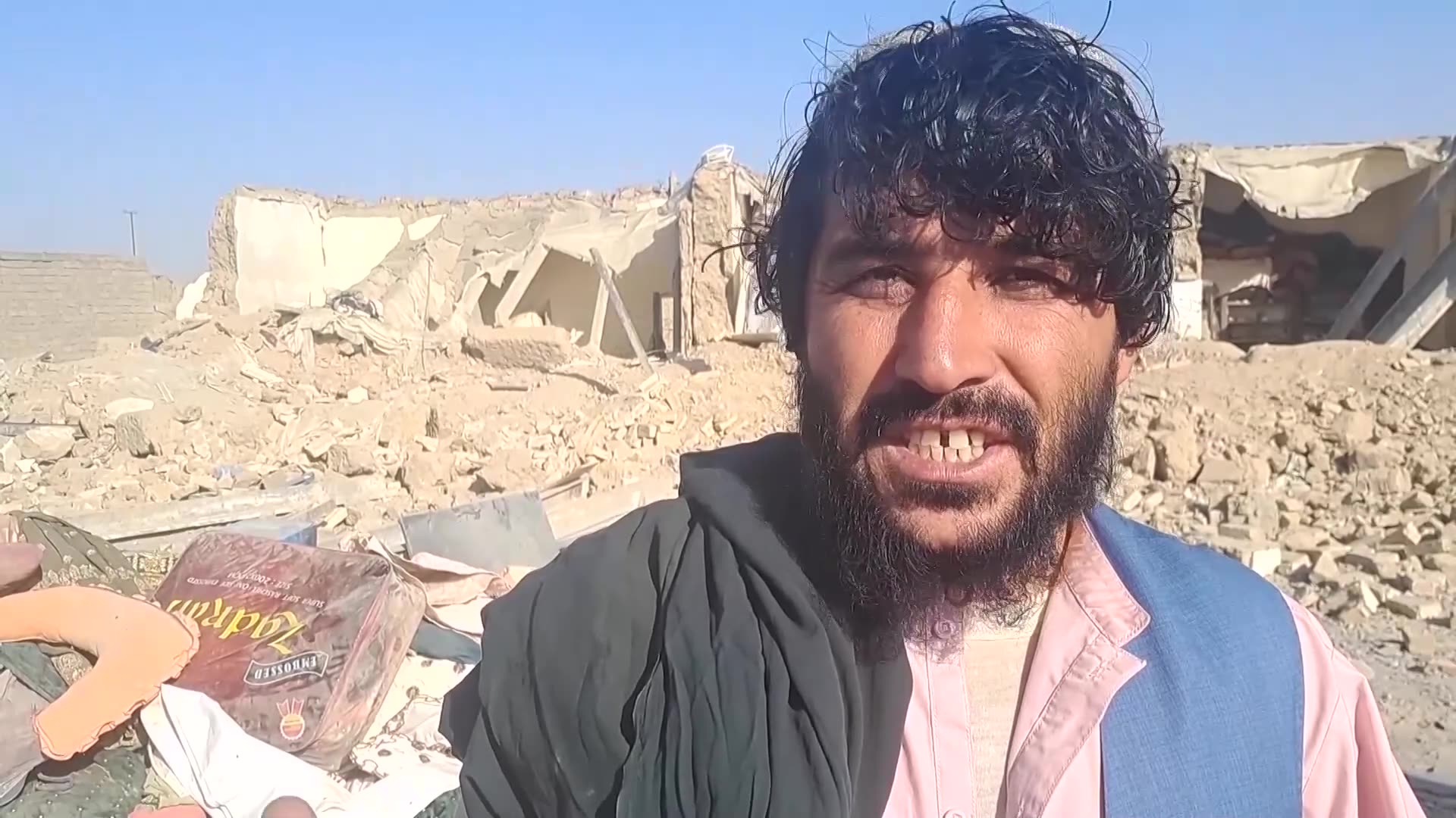 Victims treated in Kabul hospital after Pakistan-Afghanistan clashes